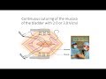 MRCOG lesson on BLADDER INJURY: diagnosis and management