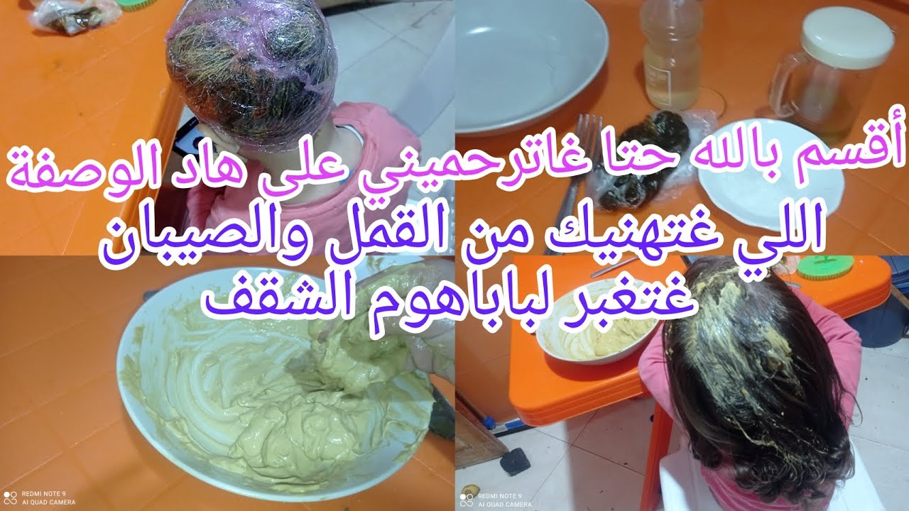 أقوى وصفة القمل والصيبان💯أقسم بالله حتى تصدمكي  النتيجة✨