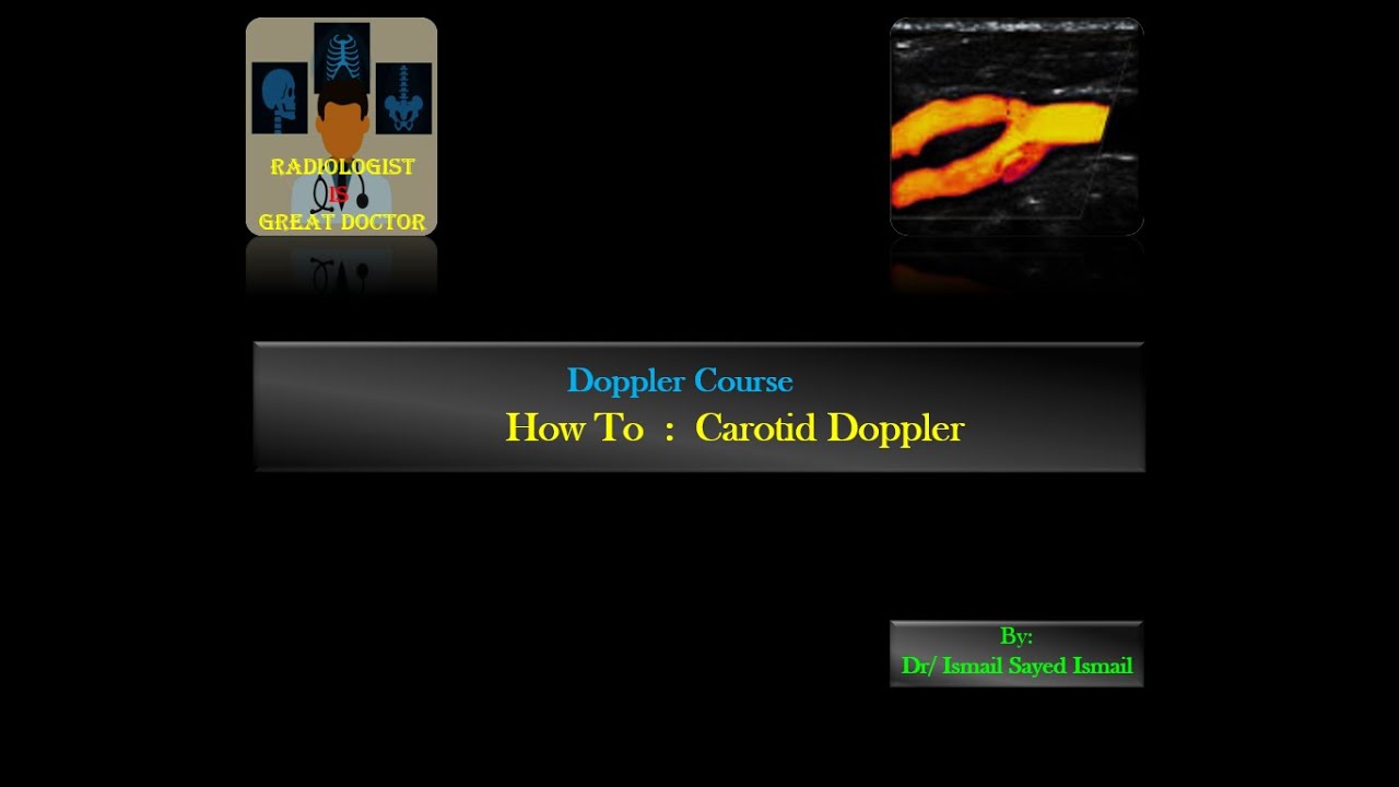 How to : Carotid Doppler (Hands-on) -Dr.Ismail Sayed Ismail