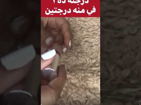 ريفيو عن كونسيلر اماندا