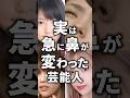 実は急に鼻が変わった芸能人！