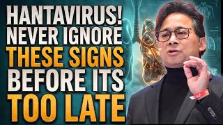 Doctors Warn: These HANTAVIRUS Signs Need Immediate Action | Dr. William Li