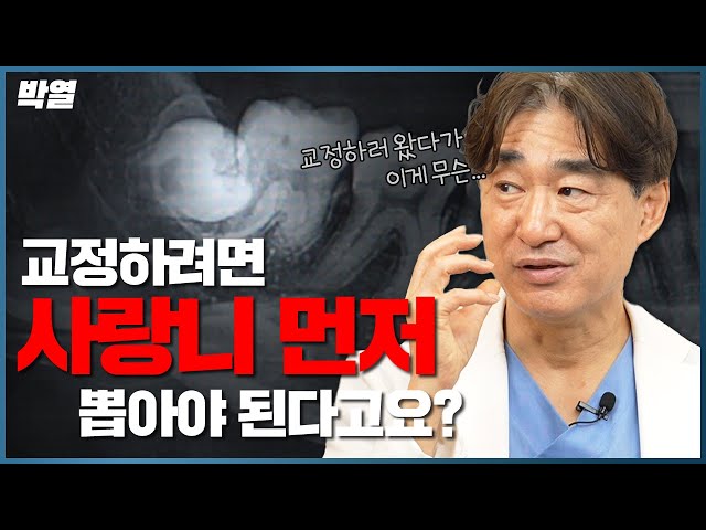 치아교정, 일단 사랑니 부터 뽑아야하는 이유!