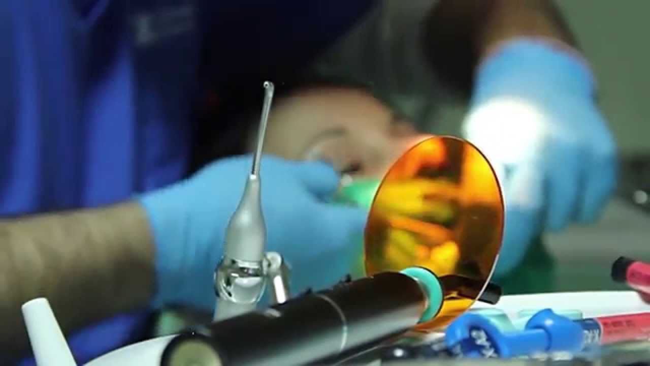 Възстановяване на липсващ зъб