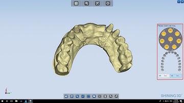 Model Scan Shining 3D Autoscan-DS-EX Dental 3D Scanner | Go3DPro.com
