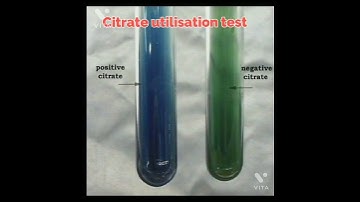 Biochemical Test of bacteria #bacteriology  #health #laboratory #shorts