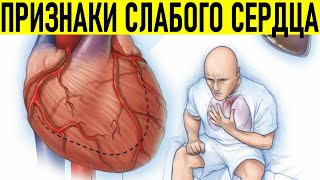 ПРИЗНАКИ ЧТО У ВАС ПРОБЛЕМЫ С СЕРДЦЕМ | 10 необычных симптомов больного сердца