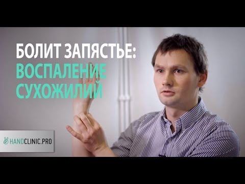 Болит запястье: частая причина, по которой болит запястье тендинит или воспаление сухожилий