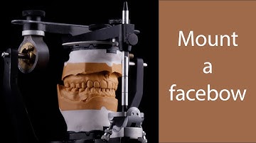 How to mount a facebow on a Hanau articulator | 2024