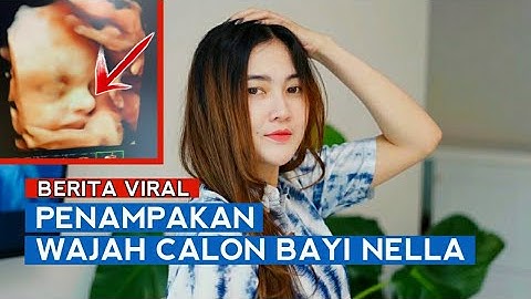 Nella Kharisma Bagikan Foto USG, Wajah Calon Bay!nya Jadi SOROTAN !!