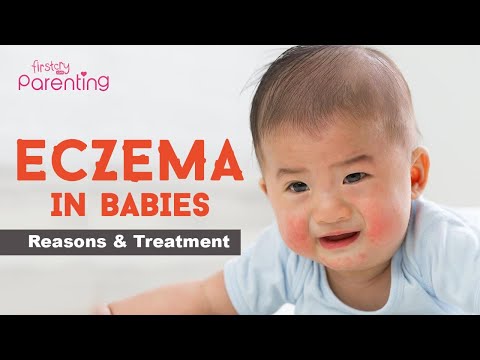 Videó: Bőrgyulladás Csecsemőknél: A Kezelés Okai és Módszerei