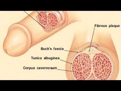 Vidéo: Masturbation. Est-ce Nocif ?