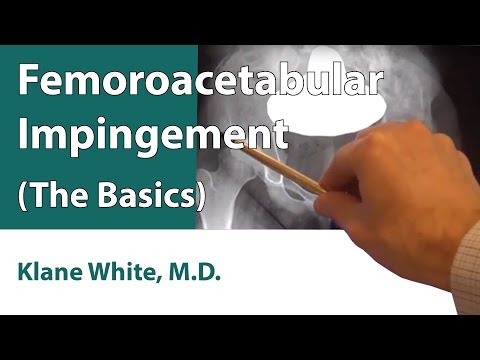 Femoroacetabulair impingement (de basis)