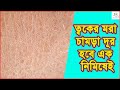 হাতের কাছের এই জিনিস গুলো দিয়ে চিরতরে দূর হবে ত্বকের মরা চামড়া || ত্বকের মরা চামড়া দূর করবেন যেভাবে