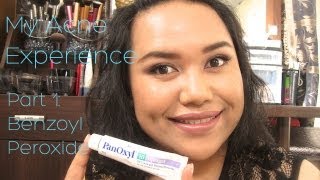 My Acne Experience Part 1: Benzoyl Peroxide