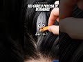 Seu cabelo precisa de viraminas #cabelos #tratamentocapilar #alimentosantiinflamatorios