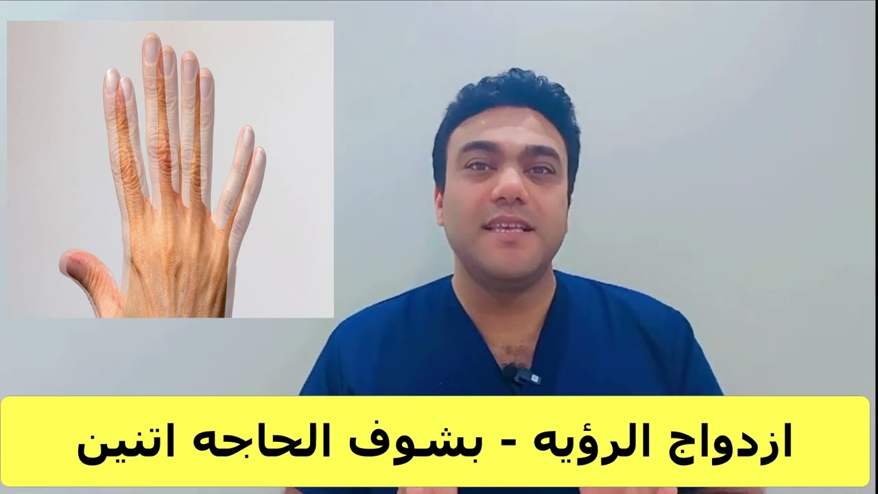 حكايه جديده بس السبب فى المخ ولا فى العين ؟