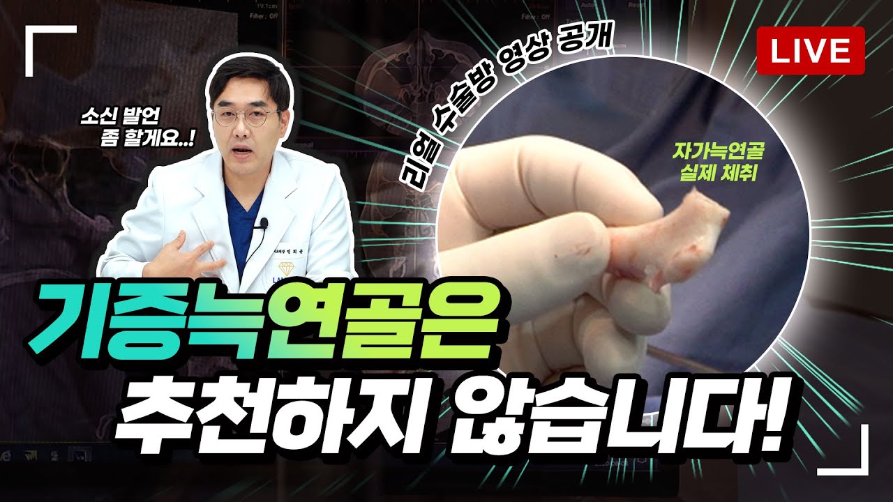 기증 늑연골보다 자가 늑연골을 선호하는 이유!😲(실제 자가 늑연골 공개)