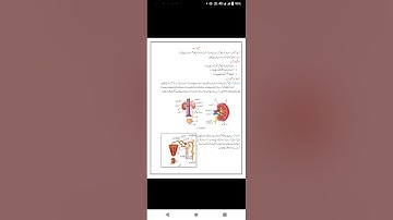 bridge course/10th Urdumedium/science2/activity 5