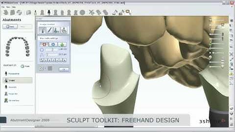 Abutment Designer