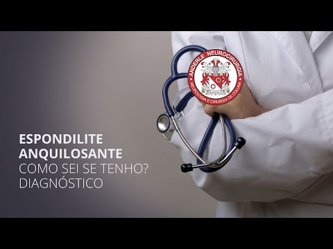 Vídeo: Como Sei Que Tenho Espondilite Anquilosante?