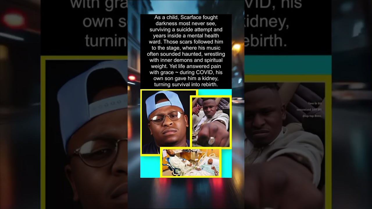 🤯😱Scarface: From Haunted Pain to a Son’s Gift of Life..🥹❤️