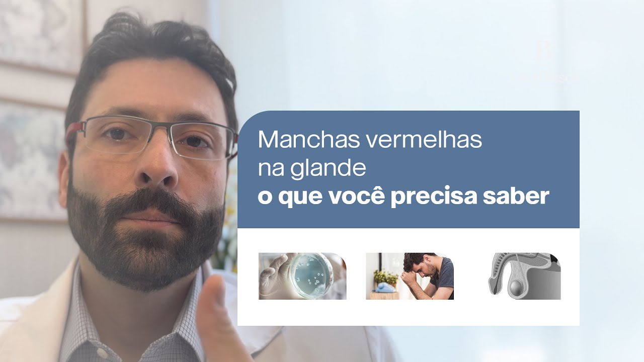 Manchas vermelhas na glande: causas e como lidar - YouTube