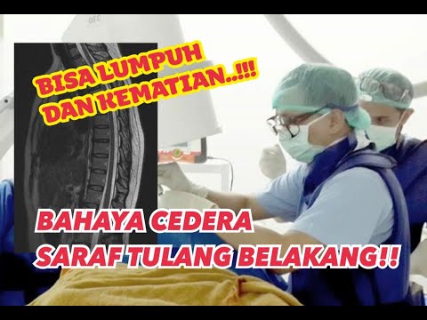 Video: Apa itu fraktur sakrum?