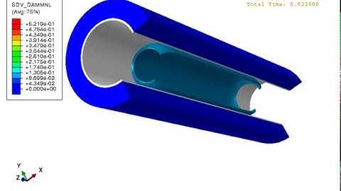 Balloon Angioplasty Simulation: Abaqus and user-defined routines