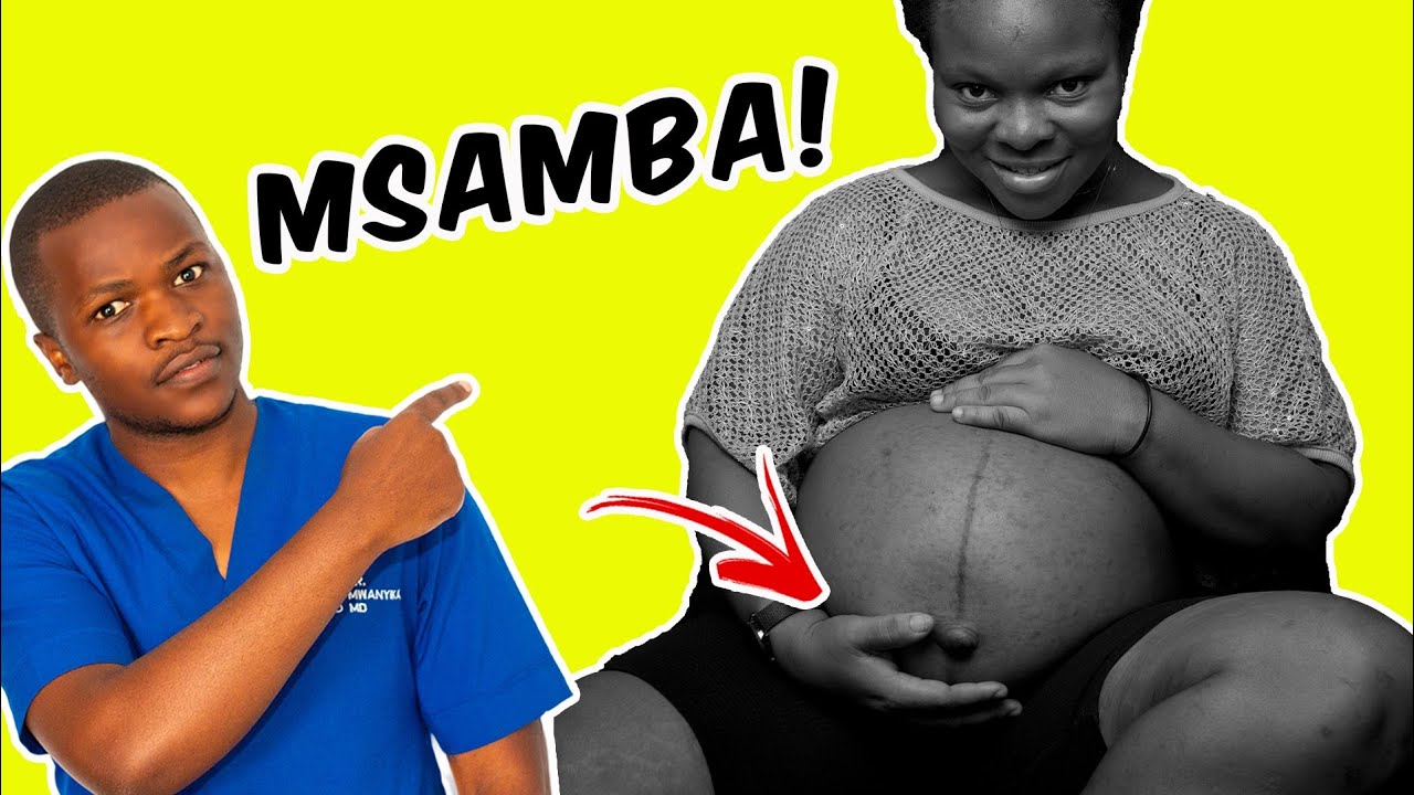 Sababu ZA Msamba Uliochanika Kutoshonwa Baada Ya Kujifungua? | Kuchanika Msamba WA Mjamzito