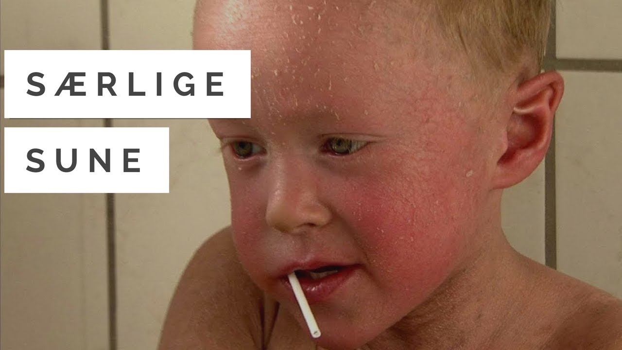 Dokumentar: Særlige Sune