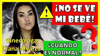 ⚠SACO GESTACIONAL SIN BEBÉ❗, ¿Hasta cuando es NORMAL❓   por GINECOLOGA DIANA ALVAREZ