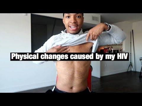 PHYSICAL CHANGES CAUSED BY MY HIV!