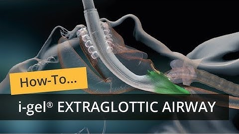 i gel Extraglottic Airway