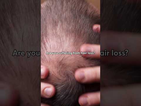 How We Restore Hair to Its Former Glory | #hairgrowth #hairtransformation #hairloss