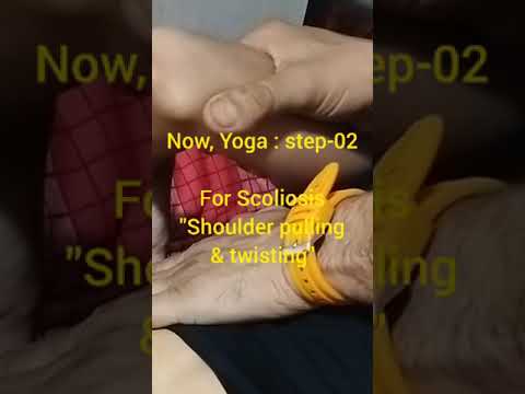 CURE SCOLIOSIS: WITHOUT OPERATION, AT HOME/पार्श्वकुब्जता : ठीक करें, बिना ऑपरेशन के