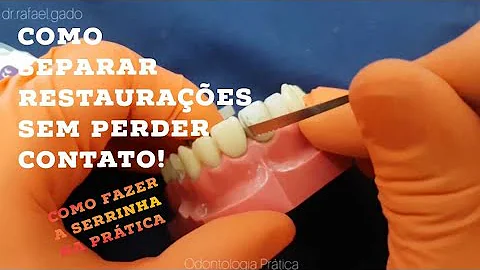 Como separar sílaba dente?