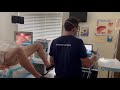 Revolutionary Rezum Procedure on an Enlarged Prostate