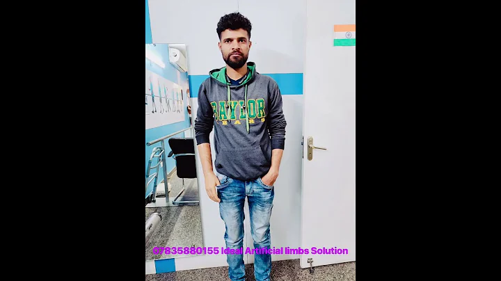 Artificial Hand |  Cosmetic silicone below elbow prosthesis | Nakli Haath | #artificiallimb