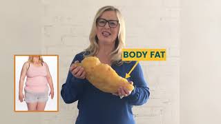 Sono Bello | Laser Liposuction | What does 5 lbs of Fat Look Like?