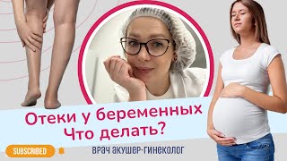 Что делать с отеками при беременности? | Виктория Матвиенко