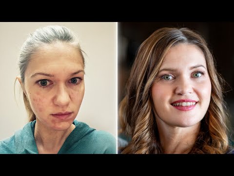 Her Autoimmune Disease is Gone | Izabella Wentz