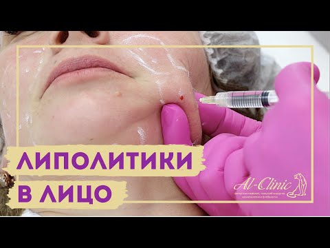 Видео: Как да намерим областта на лице на паралелепипед