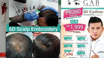 6D Scalp Embroidery by GAB Pigmentation Biñan Branch Part 1 - Preparation (Scalp Microblading)