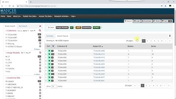 Sharing and Exporting Data in the TCIA Data Portal
