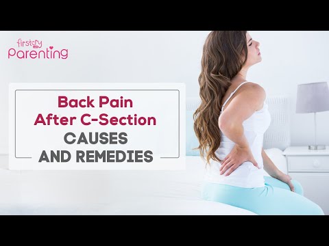 Back Pain After