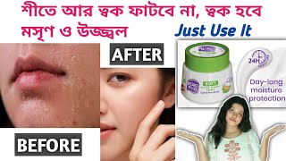 BORO PLUS SOFT Ayurvedic Antiseptic Cream Review | Winter Skin Care/শীতে ত্বকের যত্ন screenshot 5