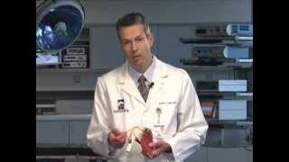 Shoulder Impingement - Dr. Stefan Tolan
