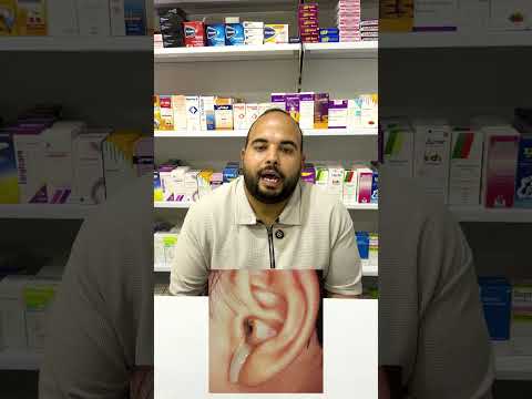 اللي بيخرج من ودنك مش دايم ا شمع ازاي تفر ق بين إفرازات الأذن الطبيعية وعلامات الخطر