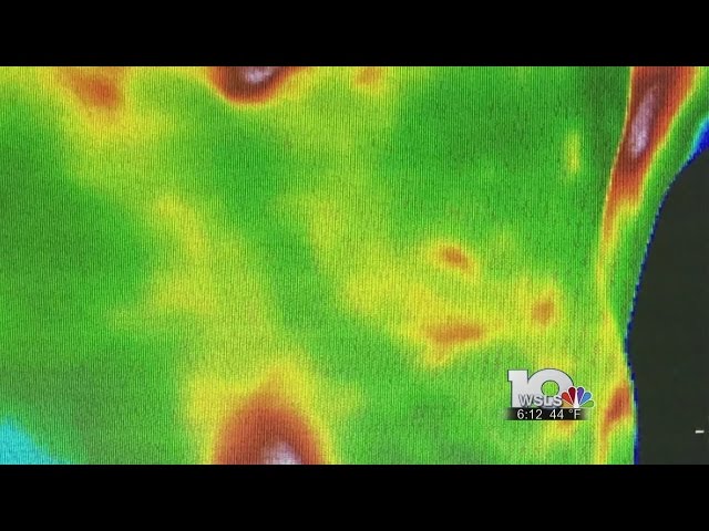 Breast Thermography